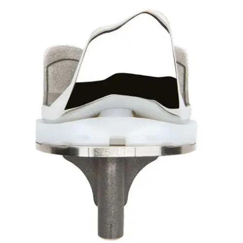 Knee Osteotomy アップデート 全人工膝関節置換術用人工膝関節 - ANTHEM™ - Smith & Nephew - 固定