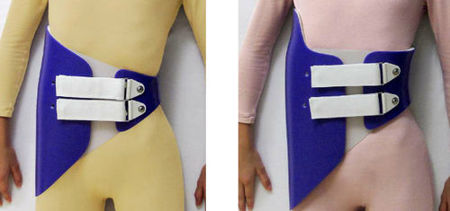 脊柱側弯症用サポートコルセット - Providence Nocturnal Scoliosis