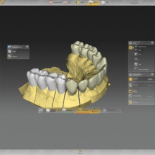 デザインソフト - inLab  - DENTSPLY MAILLEFER - CAD / FAO / 歯科技工所用