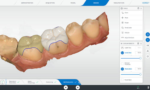 分析ソフト - CEREC - DENTSPLY MAILLEFER - モニター用 / キャプチャー / 歯科技工所用