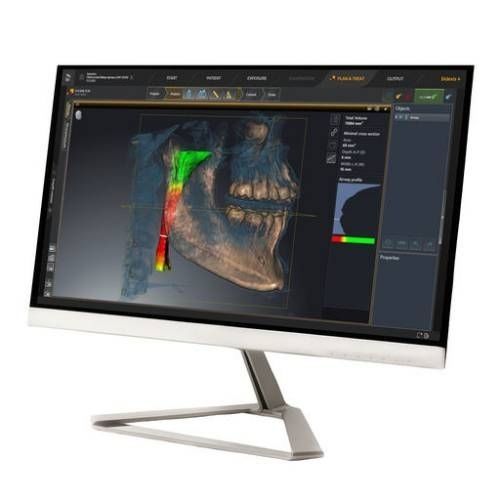 処理ソフト - SICAT suite - DENTSPLY MAILLEFER - 計画用 / 処理計画 / 航海用