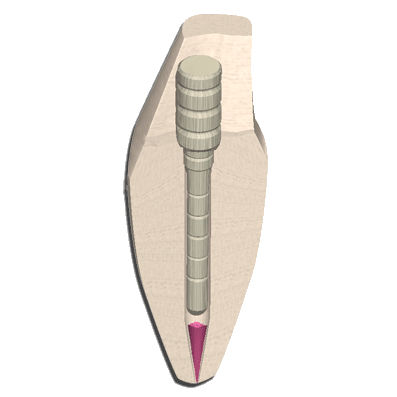 繊維ルーツポスト - EZ-Fit&reg; Fiber - ESSENTIAL DENTAL SYSTEMS  