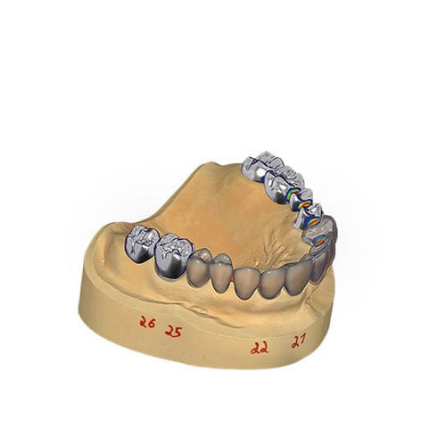 デザインソフト - DentalCAD - exocad GmbH   - CAD / 医療訓練用 / モデリング