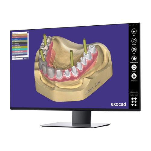 デザインソフトウェアモジュール - Implant  - exocad GmbH   - CAD / インプラント用