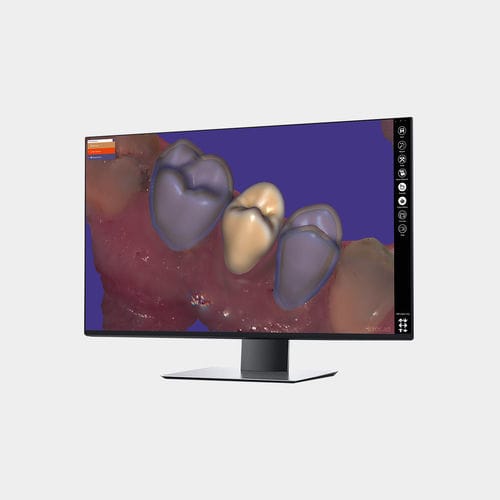 キャプチャーソフトウェアモジュール - Provisional  - exocad GmbH   - 制御 / CAD / 歯科用