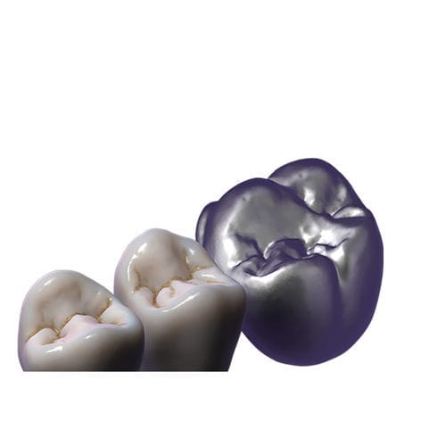 制御ソフトウェアモジュール - TruSmile  - exocad GmbH   - デザイン / CAD / 歯の修復用