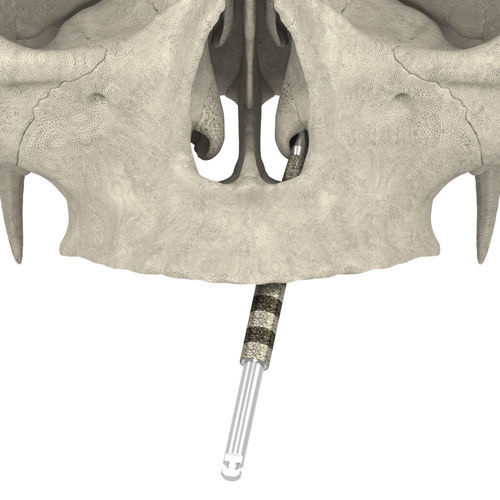 インプラント用ドリル - JDNasal TranZ  - JDENTALCARE SRL   - コーディング塗料製 / ダイアモンド