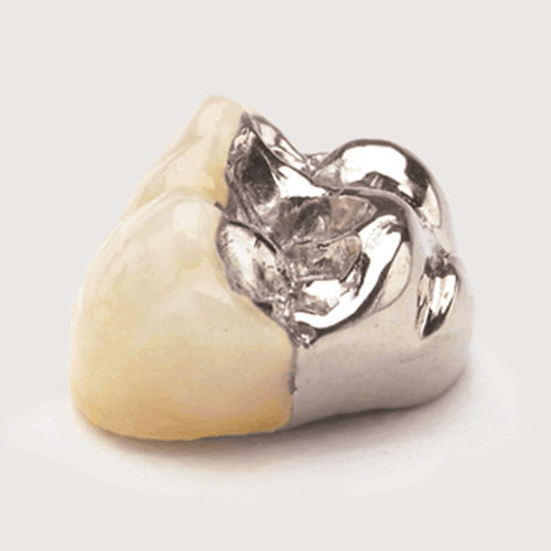 磁器製歯科材料 - JPW - Jensen Dental   - 歯の修復用 / 歯科用ブリッジ用 / 固体