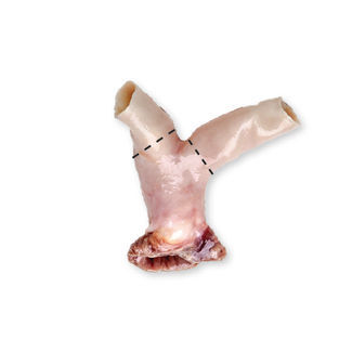 肺動脈血管バイオプロテーゼ - CardioGraft® - Lifenet Health   - 同種移植