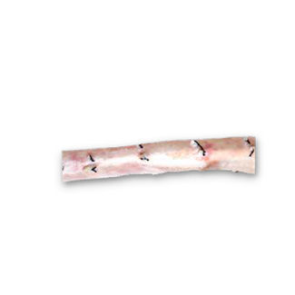 胸部大動脈の血管バイオプロテーゼ - CardioGraft® - Lifenet Health   - 同種移植
