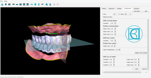 分析ソフト - BDCreator® - Merz Dental GmbH   - 制御 / 可視化 / 義歯デザイン用