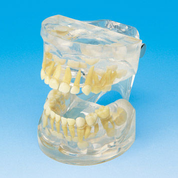 歯並び用解剖模型 - PE-PDI001 - Nissin Dental Products Inc.   - 実習用 / 子供 / 透明