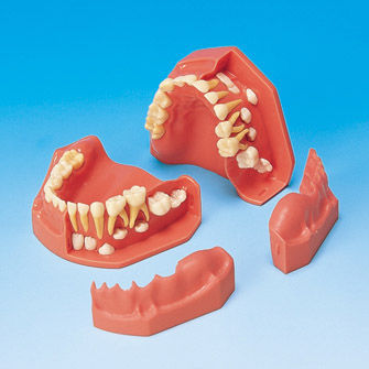 歯並び用解剖模型 - PE-PDI004 - Nissin Dental Products Inc.   - 歯茎の / 実習用 / 子供