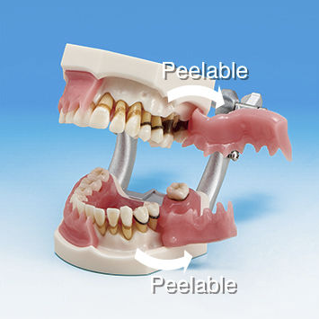 骨の解剖模型 - PE-PER003 - Nissin Dental Products Inc. - 歯並び用 / 歯茎の / 歯周用