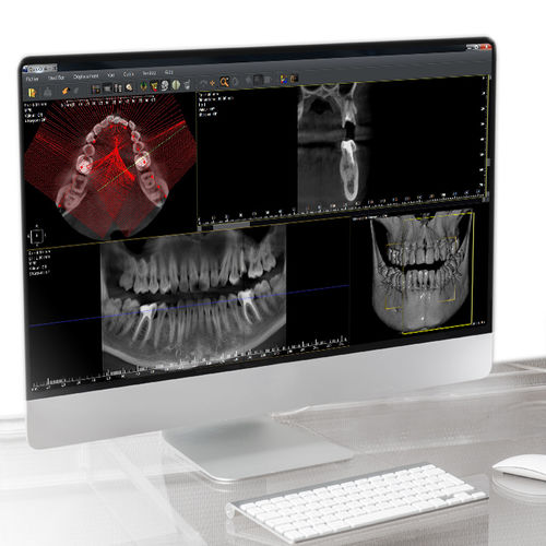 分析ソフト - QuickVision 3D - Owandy Radiology - 可視化 / 診断用 / 計画用