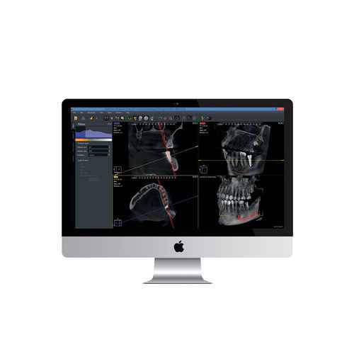 胎児頭蓋切開分析ソフト - Owandy Radiology - 診断用 / 測定用 / 処理計画