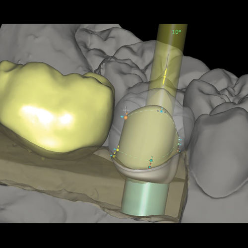 義歯デザイン用ソフトウェアモジュール - CAD/CAM Abutments - Zirkonzahn - 製造業用 / 歯科技工所用