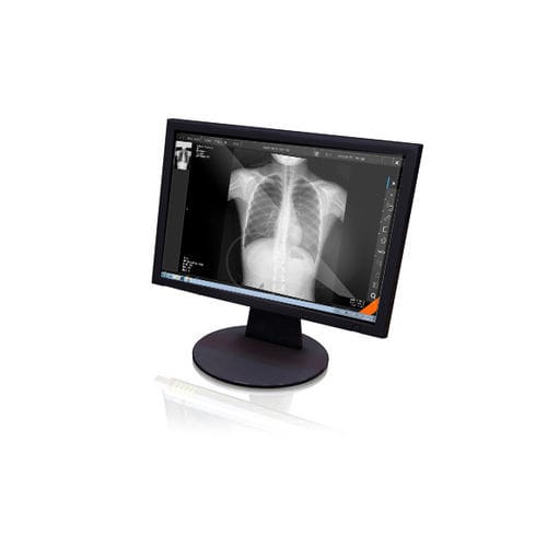放射線科用ソフト - Xview4 - GEMSS Medical Systems - 可視化 / タブレット（PC）用