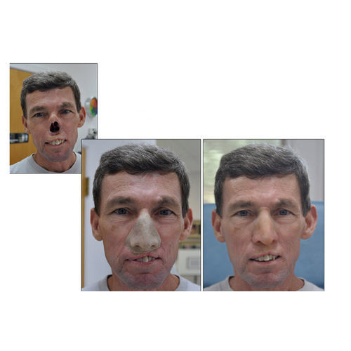 鼻美容人口装具 - RealLifeSkin™ - RealLifeSkin - 大人用