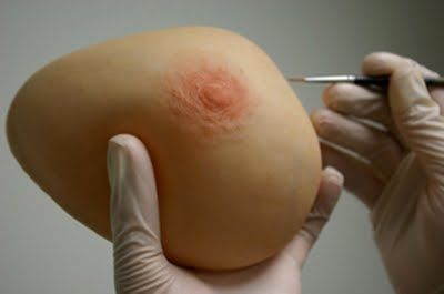 乳房美容人口装具 - The Anaplastology Clinic - 大人用