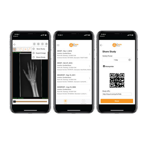 共有ソフト - CareRad - PaxeraHealth Corp - イメージ分析 / 管理用 / 制御