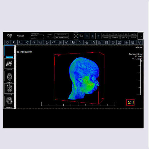 医用画像用PACS（画像保管通信システム） - Allengers Medical Systems