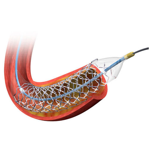 冠状動脈ステント - BIOMATRIX NEOFLEX™ - Biosensors International - ステンレススチール製 / 薬物溶出性