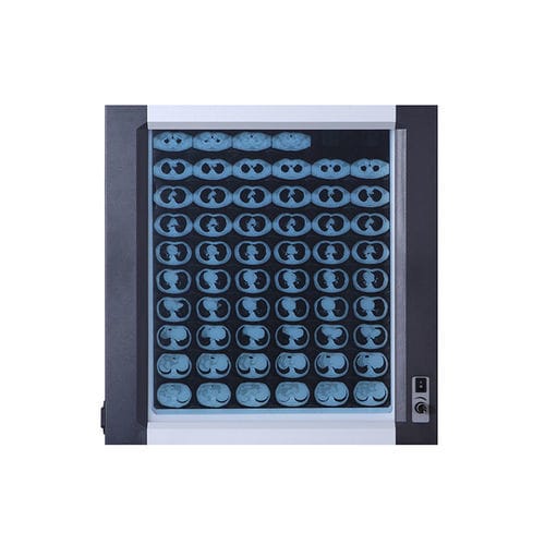 1面ネガトスコープ - Jiangsu Dengguan Medical Treatment Instrument - LED