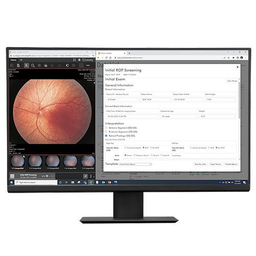 データ管理ソフト - DataLink  - Natus Medical - 診断用 / リポーティング用 / データ交換