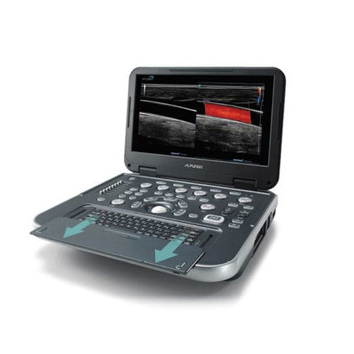 携帯型超音波装置 - E-CUBE i7 - Alpinion Medical Systems - 多目的超音波画像診断用 / カラードップラー / 内蔵コンソール