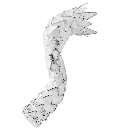 イラストでわかる実施困難症例の大動脈ステントグラフト Visualizatio… 胸部大動脈のステントグラフト - E-nside™ TAAA - Artivion