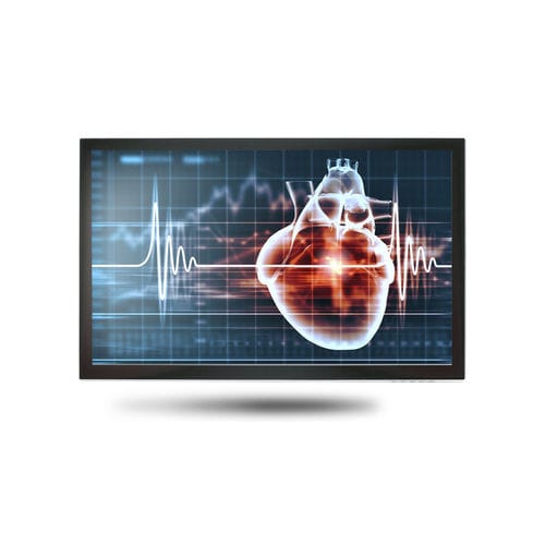 医療用モニター - MEDDP-615 - Onyx Healthcare Inc - 18.5インチ / LCD / LEDバックライト