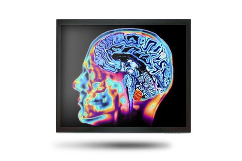 医療用モニター - MEDDP-415 - Onyx Healthcare Inc - 17インチ / LCD / LEDバックライト