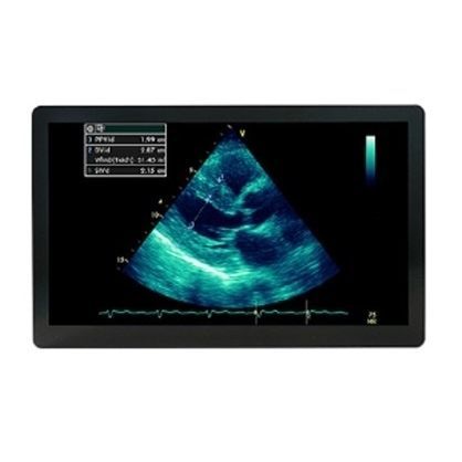 医療用モニター - MSBP2416AMC - Avalue Healthcare - 超音波画像診断用 / 外科用 / 1920 x 1080