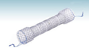 食道ステント - HANAROSTENT®BS (CCC) - M.I Tech