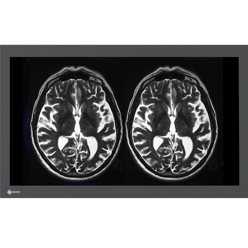 医療用モニター - LX3240-MR - EIZO GmbH - フルHD / 4K解像度 / 16:9