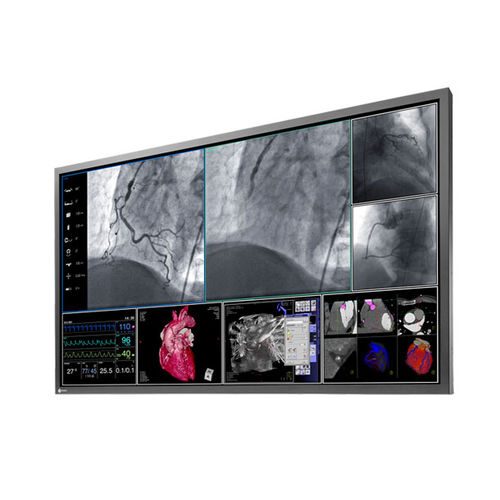 手術室用モニター - RadiForce® LS580W - EIZO GmbH - 医用画像用 / 高解像度 / 58インチ
