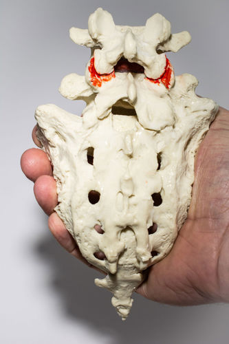 腰椎-仙椎の解剖模型 - LSTV - Dynamic Disc Designs Corp. - 実習用