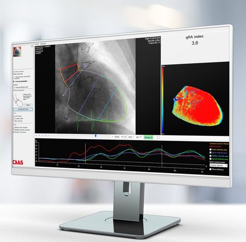 イメージ分析ソフト - Pie Medical Imaging - 診断用 / 測定用 / 処理計画