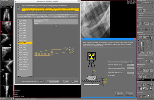 計画用ソフトウェアモジュール - dicomPACS® vet Prosthesis  - OR Technology - Oehm und Rehbein - 整形外科用 / 獣医用
