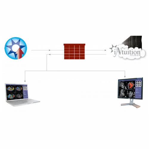 医療用クラウド コンピューティング ソリューション - iNtuition CLOUD - TeraRecon