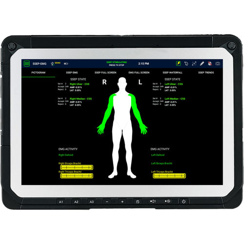 モニター用インフォメーションシステム - SafeOp™ - Alphatec Spine - 神経外科 / 歯列矯正