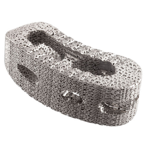 胸椎-腰椎椎体間ケージ - IdentiTi™-PC - Alphatec Spine - 後方進入 / チタン製