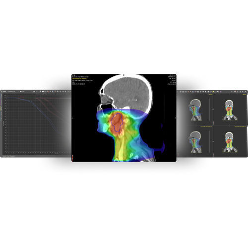 放射線量モニター用ソフト - MIM SureCalc® MonteCarlo - MIM Software - 測定用 / 計画用 / 処理