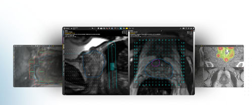 3D ヴィジュアリゼーションソフト - MIM Symphony LDR™ - MIM Software - データ収集 / 計画用 / 処理計画