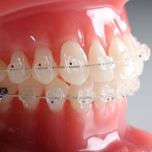エステ矯正ブラケット - Vapor™ - G&H Orthodontics - セラミック製 / 透明