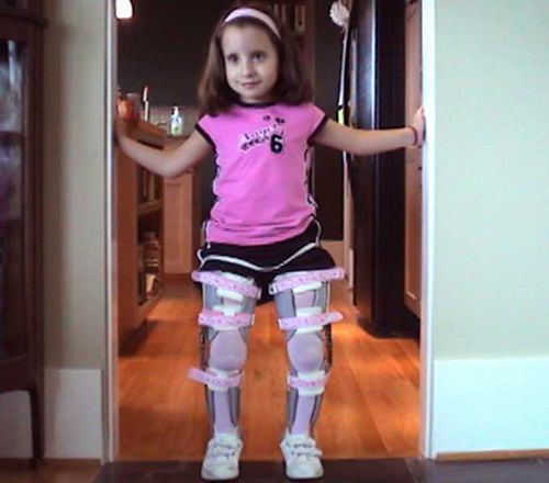 長下肢装具子供