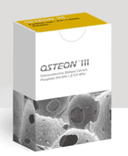 ヒドロキシアパタイト歯科材料 - OSTEON™ III - Genoss - 歯の修復用