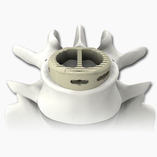 腰椎椎体間ケージ - PLATEAU®-A - Life Spine - 前方進入 / PEEK製