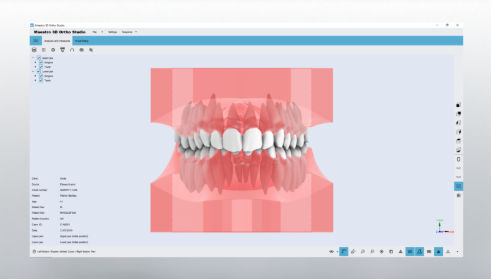 CADソフト - Studio - AGE Solutions - 3D ヴィジュアリゼーション / 歯列矯正 / 歯科技工所用